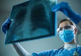 Pneumonia and Lung Infections