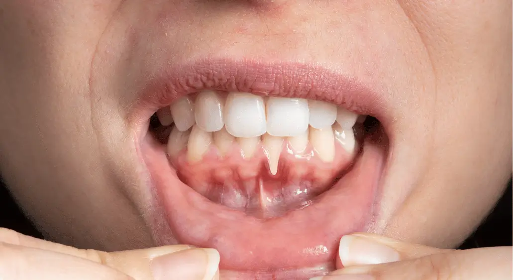 Common Dental Problems and Their Solutions: Tips from Our Clinical Experts 1 Dental & Maxillofacial - Periodontal (Gum) Treatments